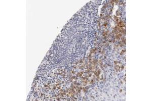 Immunohistochemical staining (Formalin-fixed paraffin-embedded sections) of human tonsil with LAX1 polyclonal antibody  shows moderate cytoplasmic positivity in lymphoid cells outside reaction center.