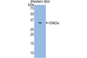 Western blot analysis of the recombinant protein. (FKBP10 Antikörper  (AA 158-440))