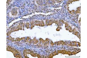 IHC analysis of GLIS1 using anti-GLIS1 antibody (ABIN7599501). (GLIS1 Antikörper  (AA 1-620))