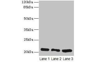 Western blot All lanes: GM2A antibody at 10 μg/mL Lane 1: Rat liver tissue Lane 2: Mouse stomach tissue Lane 3: Mouse small intestine tissue Secondary Goat polyclonal to rabbit IgG at 1/10000 dilution Predicted band size: 21 kDa Observed band size: 21 kDa (GM2A Antikörper  (AA 32-193))