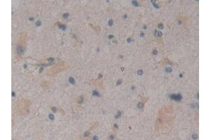 Immunohistochemistry (IHC) image for anti-Arginyl Aminopeptidase (Aminopeptidase B) (RNPEP) (AA 388-616) antibody (ABIN7443035)