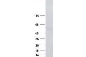 Western Blotting (WB) image for RNA Binding Motif, Single Stranded Interacting Protein 3 (RBMS3) (Transcript Variant 2) protein (Myc-DYKDDDDK Tag) (ABIN2730631)