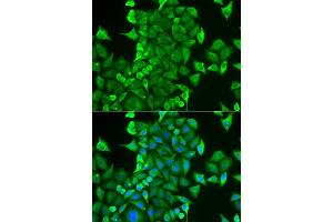 Immunofluorescence analysis of HeLa cells using CARS antibody (ABIN6129260, ABIN6137946, ABIN6137948 and ABIN6222203). (CARS Antikörper  (AA 469-748))