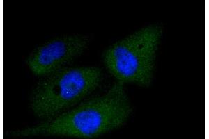 Immunofluorescence analysis of PC-3M cells using CASP3 antibody (ABIN4903137). (Caspase 3 Antikörper)
