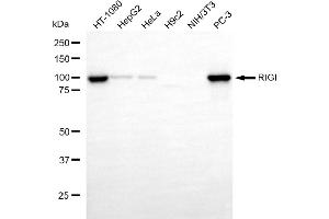 Western blotting analysis using RIGI antibody (ABIN7800966). (Rekombinanter RNA Sensor RIG-I Antikörper)