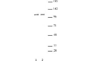 STAT2 antibody (pAb) tested by Western blot. (STAT2 Antikörper  (C-Term))