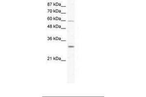 Image no. 1 for anti-DEAD (Asp-Glu-Ala-Asp) Box Polypeptide 31 (DDX31) (AA 140-189) antibody (ABIN203216)
