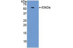 Western blot analysis of recombinant Human PSMC3. (PSMC3 Antikörper  (AA 2-439))