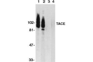 Image no. 1 for anti-ADAM Metallopeptidase Domain 17 (ADAM17) (C-Term) antibody (ABIN201454) (ADAM17 Antikörper  (C-Term))