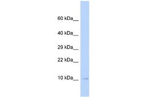 WB Suggested Anti-SUMO3 Antibody Titration: 0. (SUMO3 Antikörper  (Middle Region))