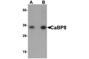 Western blot analysis of CaBP8 in 3T3 cell lysate with CaBP8 antibody at (A) 1 and (B) 2 μg/ml. (Calneuron 1 Antikörper  (N-Term))