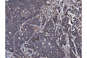 IHC analysis of NSF using anti-NSF antibody (ABIN7601630). (NSF Antikörper  (AA 4-636))