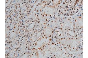 ABIN6268991 at 1/200 staining human kidney tissue sections by IHC-P. (PPP1R12A Antikörper  (pThr853))