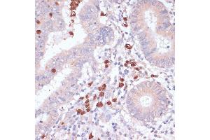 Immunohistochemistry of paraffin-embedded human colon using CD82 antibody (ABIN6131855, ABIN6138233, ABIN6138234 and ABIN6218884) at dilution of 1:100 (40x lens). (CD82 Antikörper  (C-Term))
