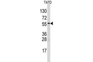 Image no. 1 for anti-Aldehyde Dehydrogenase 6 Family, Member A1 (ALDH6A1) (N-Term) antibody (ABIN356978) (ALDH6A1 Antikörper  (N-Term))