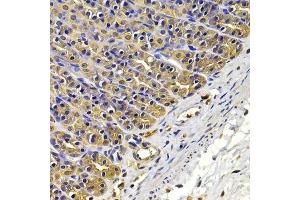 Immunohistochemistry of paraffin-embedded rat stomach using FSCN1 antibody. (Fascin Antikörper  (AA 394-493))