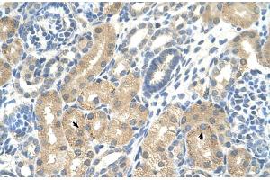 Rabbit Anti-KHK Antibody  Paraffin Embedded Tissue: Human Kidney Cellular Data: Epithelial cells of renal tubule Antibody Concentration: 4. (Ketohexokinase Antikörper  (C-Term))