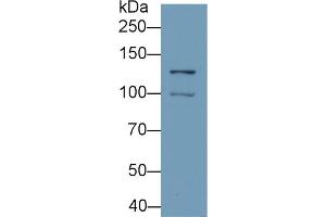 Western Blotting (WB) image for anti-Hypoxia Inducible Factor 1, alpha Subunit (Basic Helix-Loop-Helix Transcription Factor) (HIF1A) (AA 218-506) antibody (ABIN7426046)