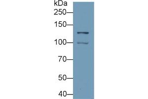 Detection of HIF1a in Hela cell lysate using Monoclonal Antibody to Hypoxia Inducible Factor 1 Alpha (HIF1a) (HIF1A Antikörper  (AA 218-506))