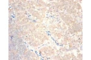 Immunohistochemistry of paraffin-embedded human lymph node tissue using ABIN7145987 at dilution of 1:100 (CCL24 Antikörper  (AA 27-119))