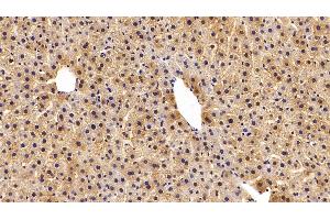 Detection of GSTa3 in Rat Liver Tissue using Polyclonal Antibody to Glutathione S Transferase Alpha 3 (GSTa3) (GSTA3 Antikörper  (AA 1-222))