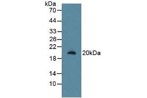 Detection of RSPO1 in Rat Uterus Tissue using Polyclonal Antibody to R-Spondin 1 (RSPO1) (RSPO1 Antikörper  (AA 136-262))