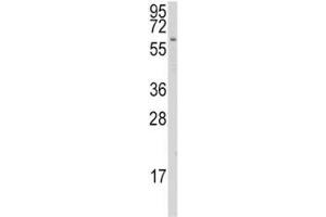Western Blotting (WB) image for anti-Cytochrome P450, Family 1, Subfamily A, Polypeptide 1 (CYP1A1) (AA 377-405) antibody (ABIN3030670)