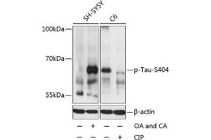 Western blot analysis of extracts of SH-SY5Y and C6 cells, using Phospho-Tau-S404 antibody (ABIN3019703, ABIN3019704, ABIN3019705 and ABIN1681813) at 1:2000 dilution.