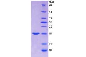 SDS-PAGE analysis of Human Annexin A2 Protein.