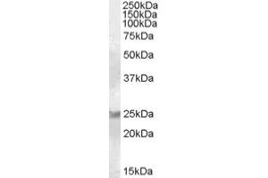 Image no. 1 for anti-RAB8A, Member RAS Oncogene Family (RAB8A) (C-Term) antibody (ABIN374945) (RAB8A Antikörper  (C-Term))