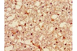 Immunohistochemistry of paraffin-embedded human brain tissue using ABIN7149942 at dilution of 1:100 (GNPAT Antikörper  (AA 589-680))