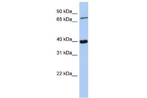WB Suggested Anti-PRDM4 Antibody Titration:  0. (PRDM4 Antikörper  (C-Term))