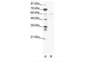 Image no. 1 for anti-Zinc Finger Protein 92 (ZNF92) (C-Term) antibody (ABIN203188) (ZNF92 Antikörper  (C-Term))