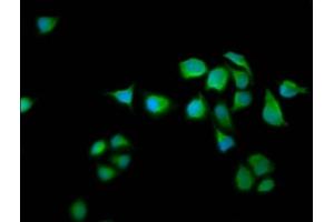 Immunofluorescence staining of Hela cells with ABIN7167153 at 1:66, counter-stained with DAPI. (RASAL2 Antikörper  (AA 749-835))