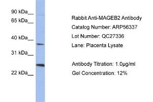 WB Suggested Anti-MAGEB2  Antibody Titration: 0. (MAGEB2 Antikörper  (N-Term))