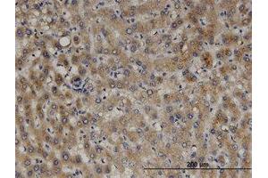 Image no. 1 for anti-Peroxisomal Biogenesis Factor 11 beta (PEX11B) (AA 1-99) antibody (ABIN599479) (PEX11B Antikörper  (AA 1-99))