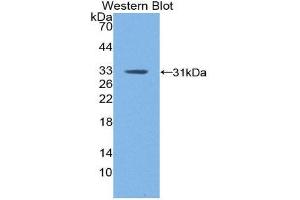 Western Blotting (WB) image for anti-Coagulation Factor XIII, A1 Polypeptide (F13A1) (AA 372-616) antibody (ABIN2119057)
