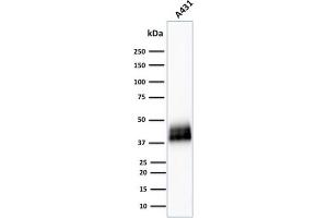 Western Blot Analysis of human A431 cell lysate using TACSTD2 / TROP2 Mouse Monoclonal Antibody (TACSTD2/2151).
