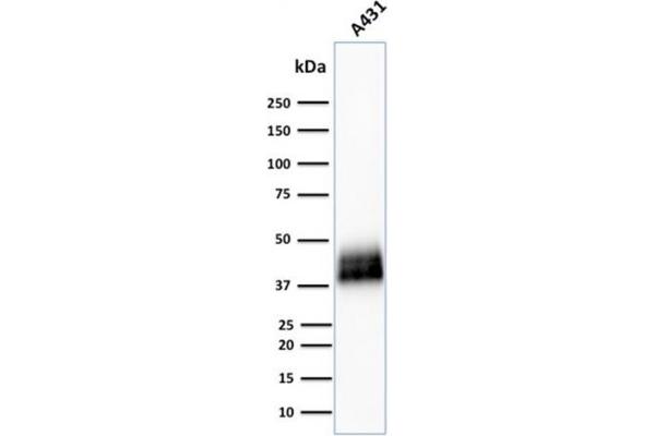 TACSTD2 Antikörper  (AA 31-274)