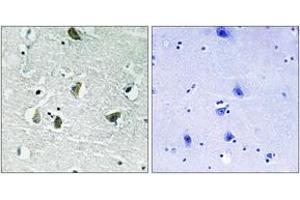 Immunohistochemistry analysis of paraffin-embedded human brain, using JAK2 (Phospho-Tyr931) Antibody. (JAK2 Antikörper  (pTyr931))