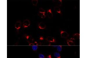 Confocal immunofluorescence analysis of Hela cells using USO1 Polyclonal Antibody at dilution of 1:200. (USO1 Antikörper)