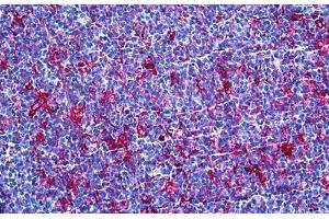 Immunohistochemistry (Formalin-fixed Paraffin-embedded Sections) (IHC (fp)) image for anti-Gelsolin (GSN) (AA 673-783) antibody (ABIN626060)