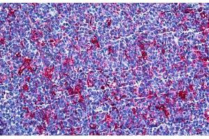 Human Tonsil: Formalin-Fixed, Paraffin-Embedded (FFPE) (Gelsolin Antikörper  (AA 673-783))