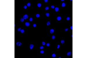 Confocal Immunofluorescent analysis of Ramos cells using AF488-labeled Isotype Control MAb (IgG2a) (Green). (IgL Antikörper)