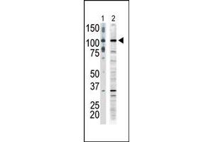 Image no. 1 for anti-Mitogen-Activated Protein Kinase Kinase Kinase 9 (MAP3K9) (C-Term) antibody (ABIN360307) (MAP3K9 Antikörper  (C-Term))