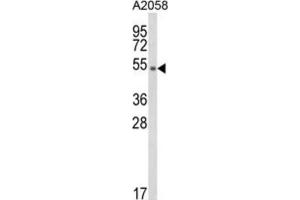 Western Blotting (WB) image for anti-Disabled Homolog 2, Mitogen-Responsive phosphoprotein (Drosophila) (DAB2) antibody (ABIN3003993) (DAB2 Antikörper)