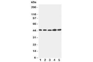 Western blot testing of Hepsin antibody and Lane 1:  293T (Hepsin Antikörper  (C-Term))