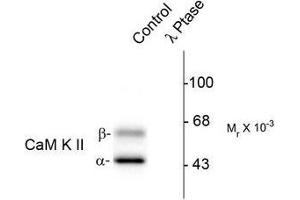 Image no. 1 for anti-Calcium/calmodulin-Dependent Protein Kinase II alpha (CAMK2A) (pThr286) antibody (ABIN372594)