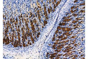 ABIN6266008 and ABIN6278040 at 1/100 staining Rat stomach tissue by IHC-P. (WARS Antikörper  (Internal Region))