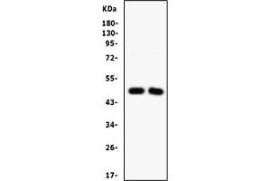 Western blot analysis of SFRP4 using anti-SFRP4 antibody (ABIN3044543). (SFRP4 Antikörper  (AA 22-303))